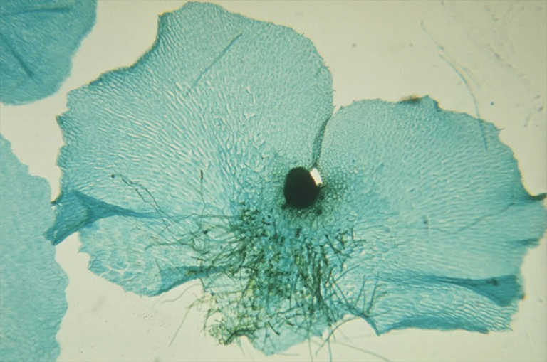 蕨類植物Prothallia