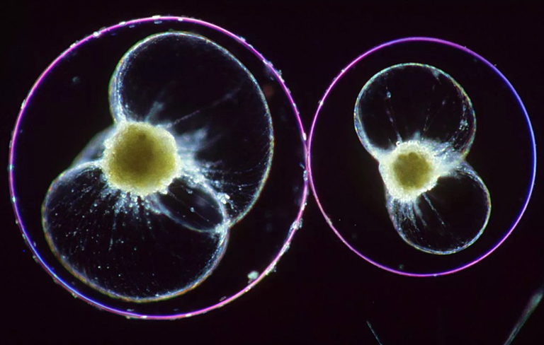 鞭毛蟲.jpg 鞭毛蟲