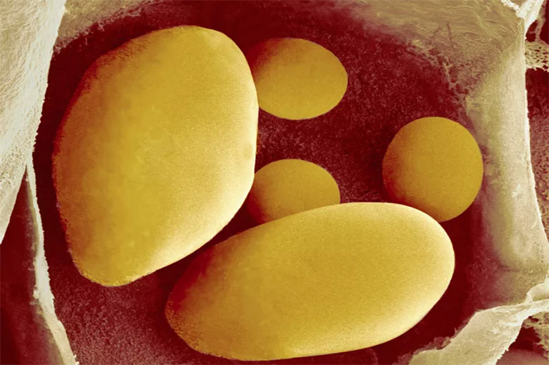 淀粉糊質.jpg 淀粉糊質