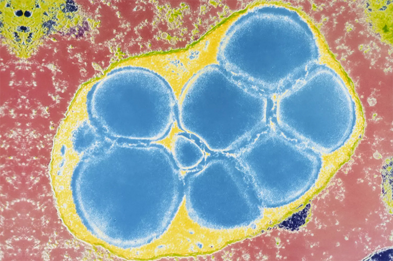 淀粉糊.jpg 淀粉糊