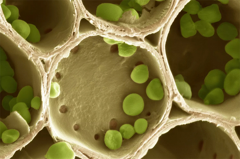 淀粉粒-碳水化合物.jpg 淀粉粒-碳水化合物